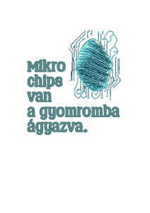 Mikrochips van a gyomromban